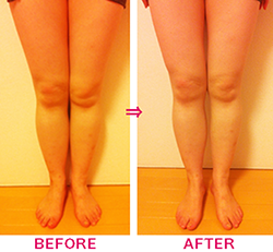 口コミで人気の美脚子コース